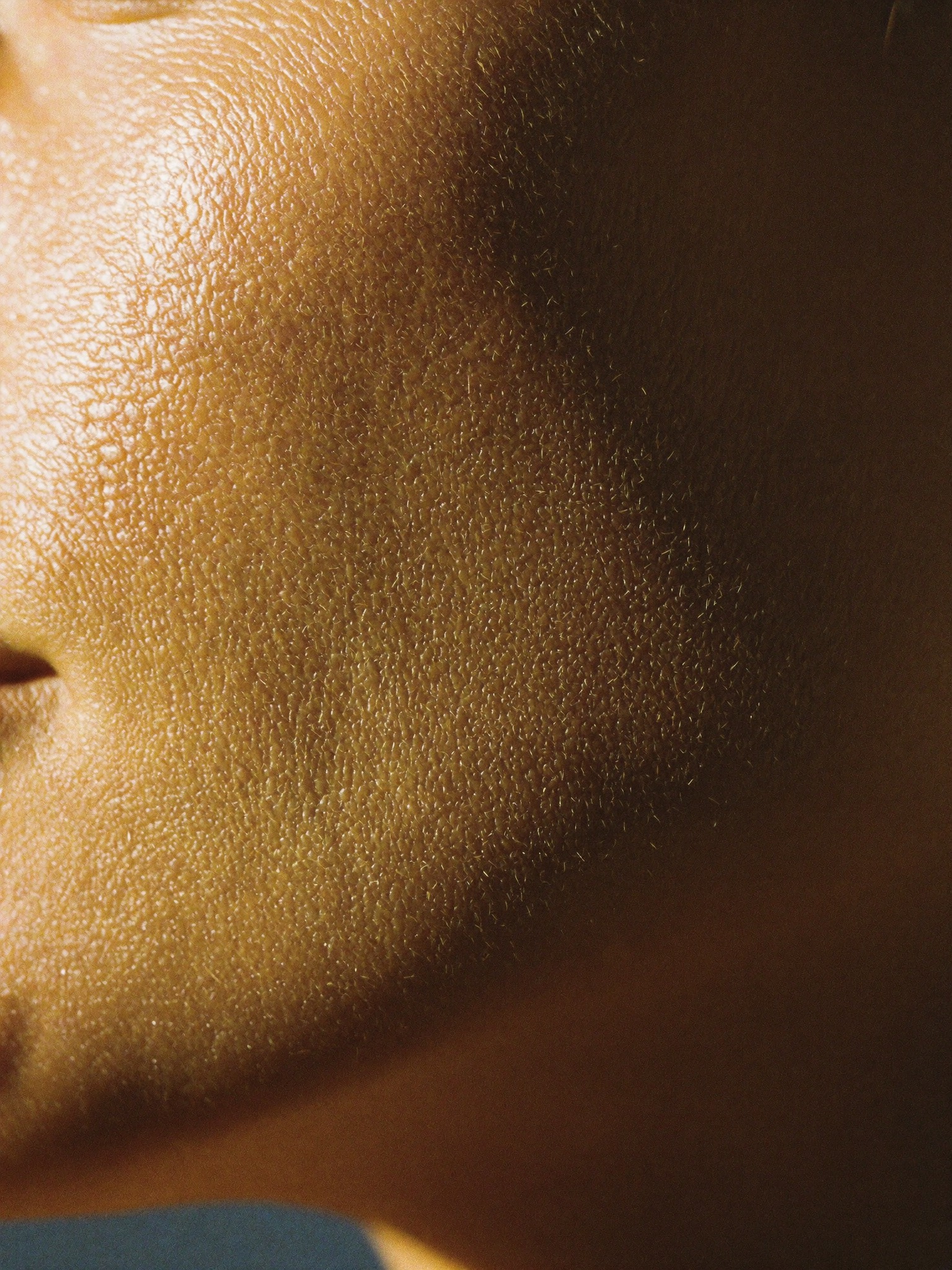 Bild · Profhilo oder Skinbooster?